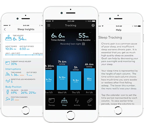sleep-insights